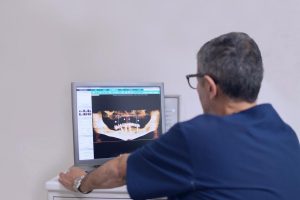 Studio Tarallo Dentista Torino - Impianti